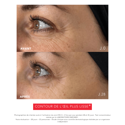 EYE C+ Soin regard Anti-âge Avant/Après Rides Laboratoire ENEOMEY