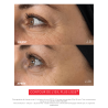 EYE C+ Soin regard Anti-âge Avant/Après Rides Laboratoire ENEOMEY
