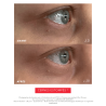 EYE C+ Soin regard Anti-âge Avant/Après Cernes Laboratoire ENEOMEY