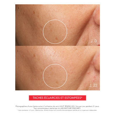 LIGHT RENEW GEL, Gel de nuit dépigmentant régulateur | Résultats prouvées