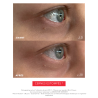 EYE C+, Revitalizing anti-aging eye care, Anti-aging programs | Laboratoire ENEOMEY