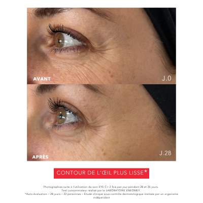EYE C+, Revitalizing anti-aging eye care, Anti-aging programs | Laboratoire ENEOMEY