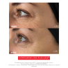 EYE C+, Revitalizing anti-aging eye care, Anti-aging programs | Laboratoire ENEOMEY