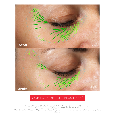 EYE C+, Revitalizing anti-aging eye care, Anti-aging programs | Laboratoire ENEOMEY