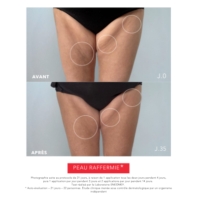 PERFECT BODY 30, Firming Body Lotion | Laboratoire ENEOMEY