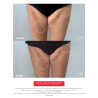 PERFECT BODY 30, Firming Body Lotion | Laboratoire ENEOMEY