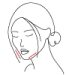 Loss of density